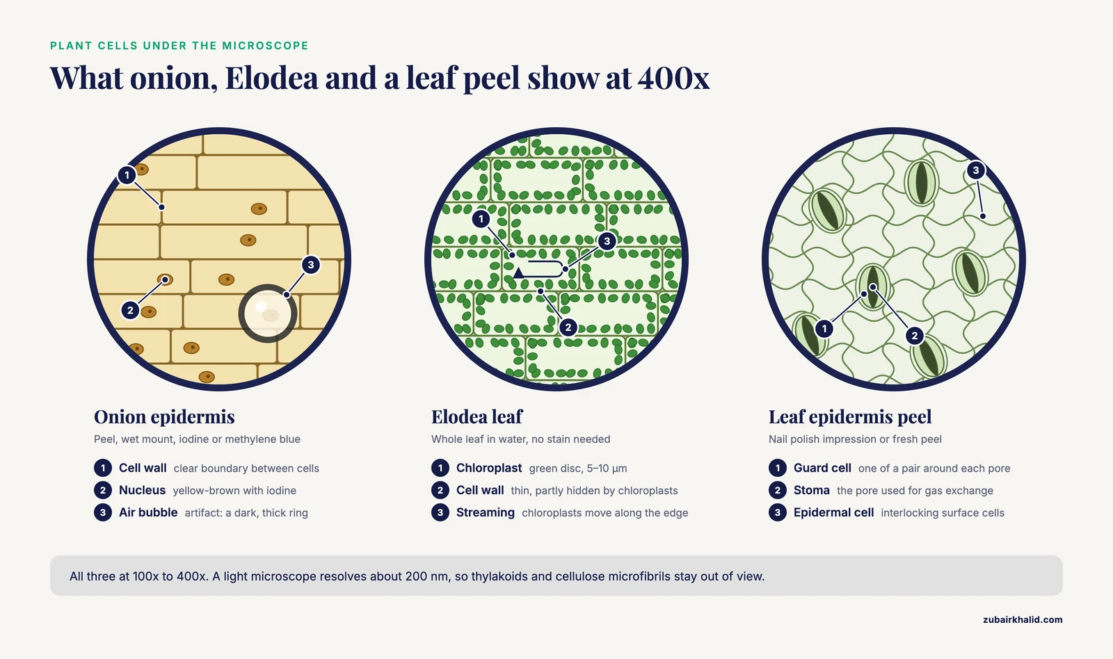 Plant cells through a microscope: onion epidermis with nuclei, Elodea cells lined with chloroplasts, and stomata in a leaf peel