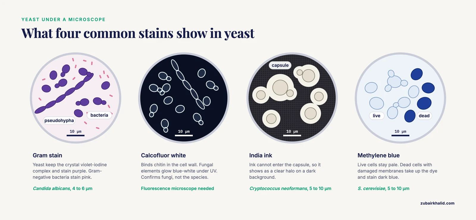 Yeast under a microscope in four stains: Gram-stained Candida, calcofluor walls, India ink capsule halos, methylene blue live and dead