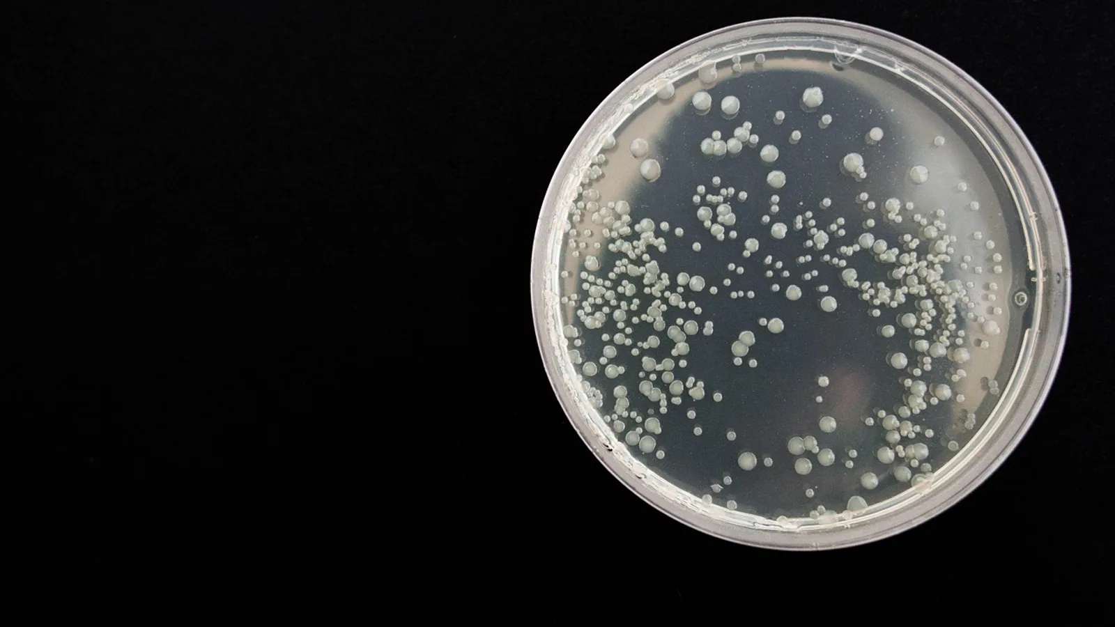 Genetic Transduction: How Phages Move Bacterial Genes