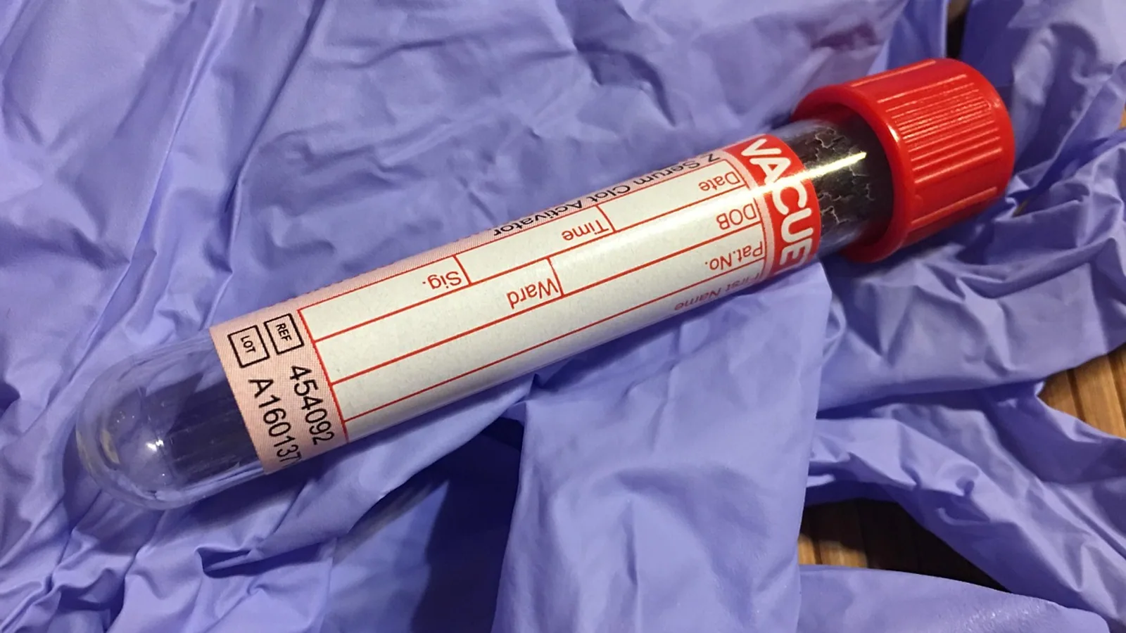 High BUN Blood Test: Causes and What to Do Next