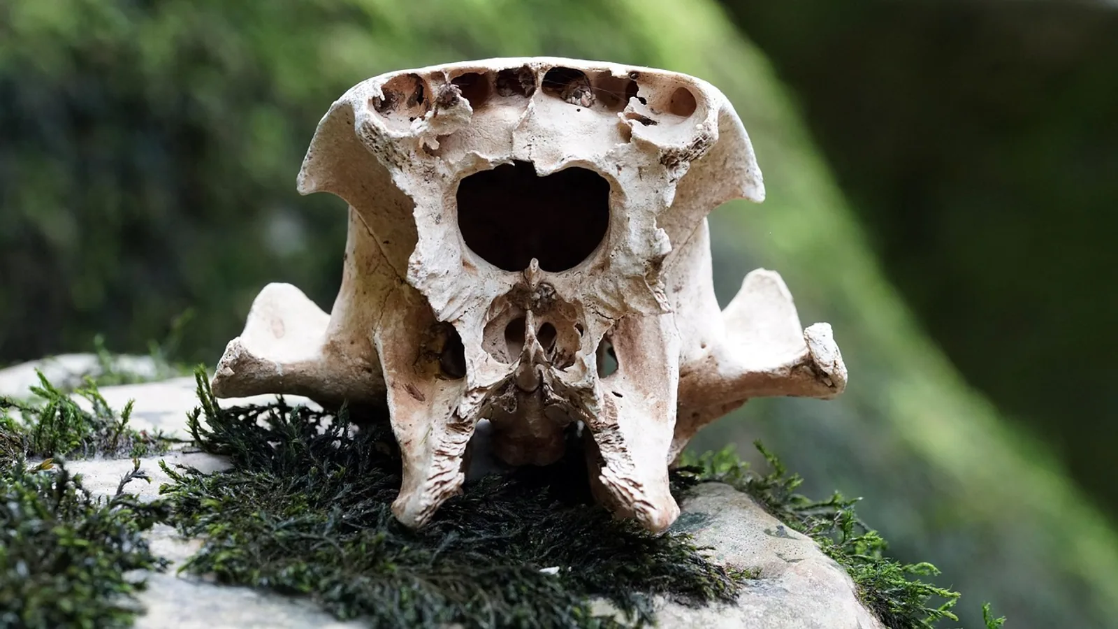 Spongy Bone: Structure, Function, and Histology