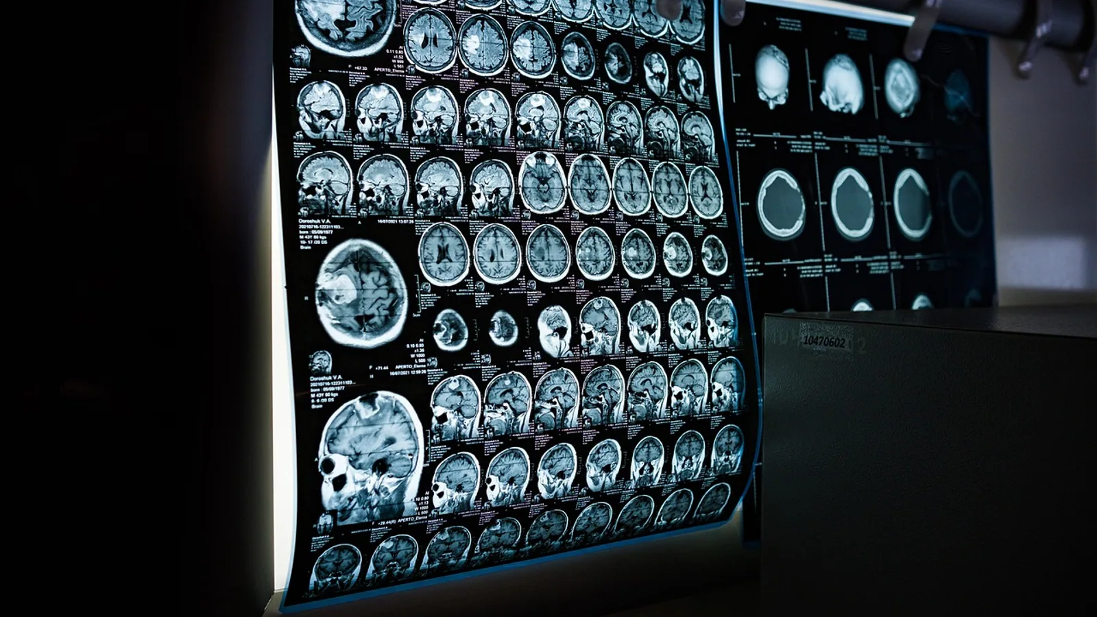 Thalamus Function: Relay and Processing