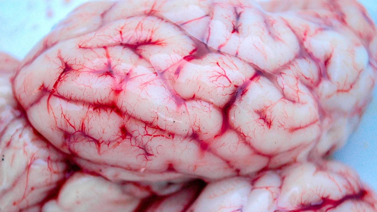 Phrenic Nerve: Origin, Course, and Function
