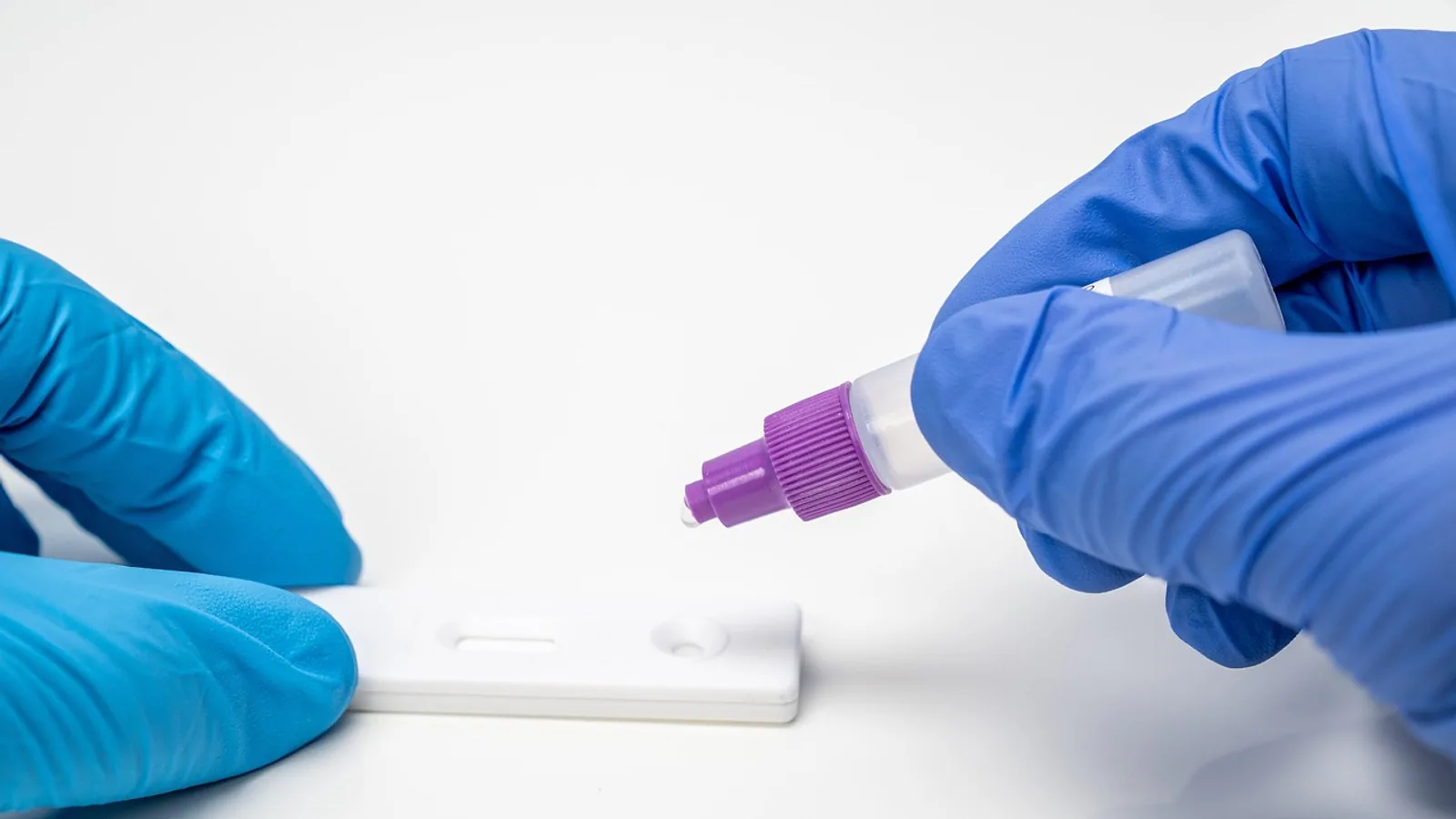 Susceptible Definition: Meaning in Medicine and Biology