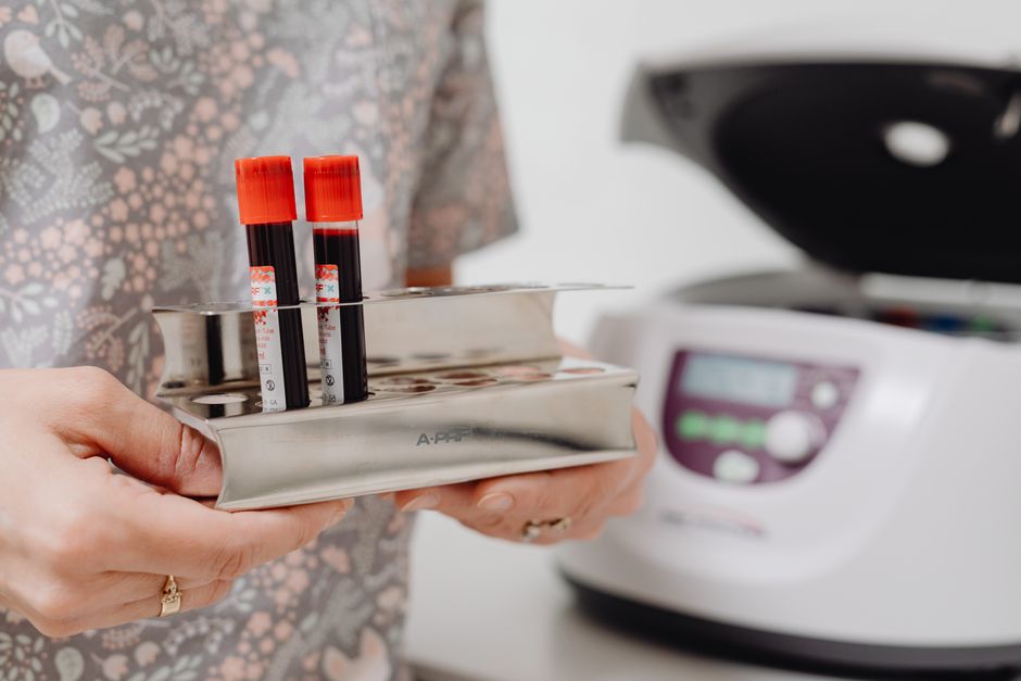 Hematology Analyzer Troubleshooting: Common Issues and Solutions