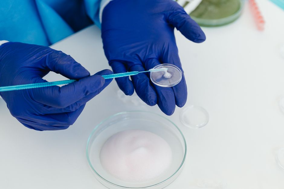 Viable Plate Count Method: Principles and Applications in Microbiology