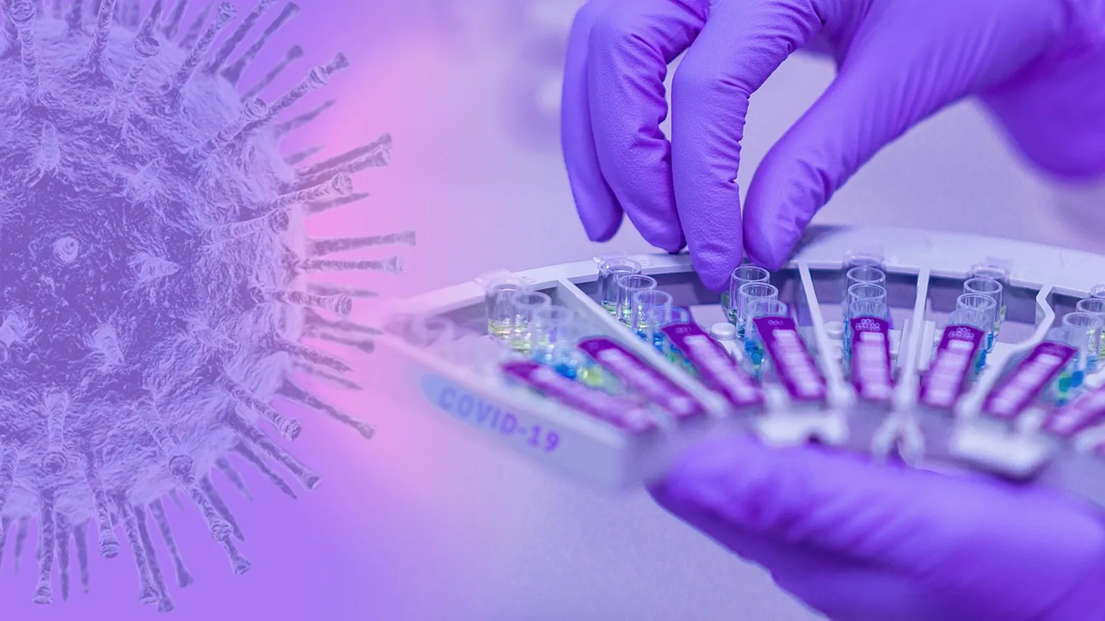 What Is Cyclospora cayetanensis? Infection Guide