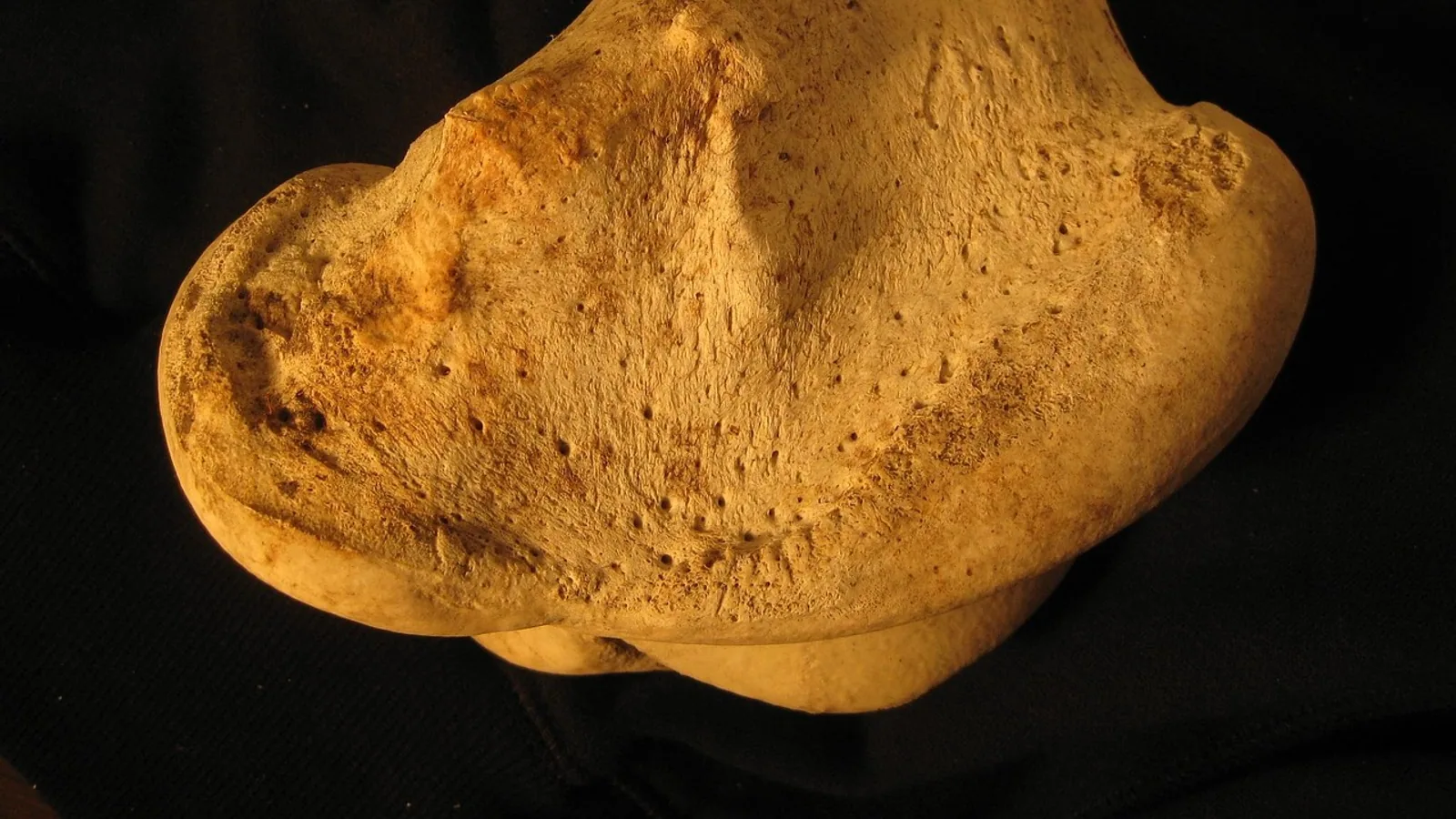 Greater Trochanter: Anatomy, Attachments, and Role