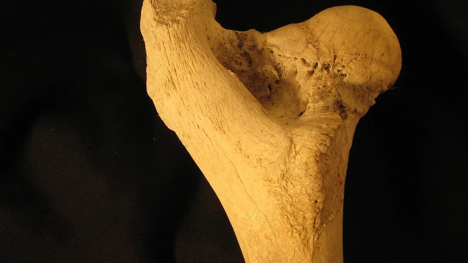 Adductor Femoris: Anatomy and Function