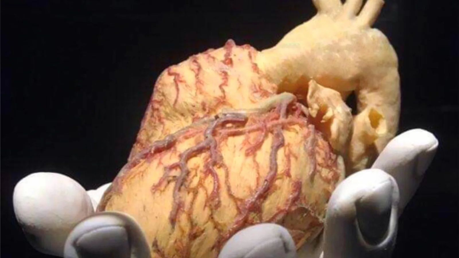 Purkinje System: Cardiac Conduction Explained