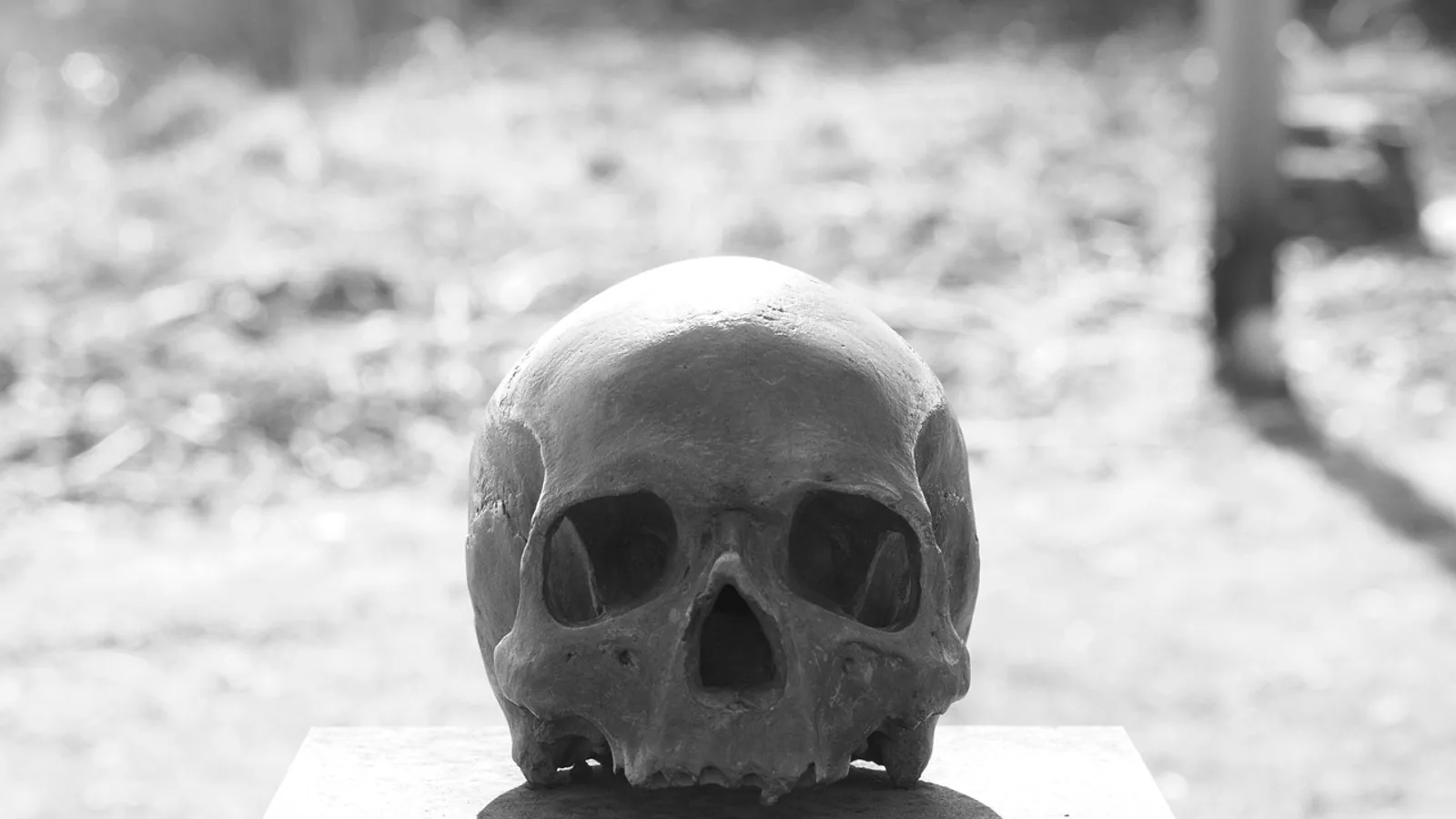 Bones of the Face: Facial Skeleton Anatomy