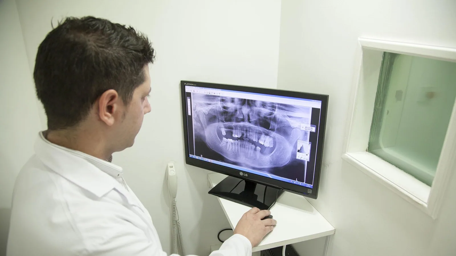 Coronoid Process Anatomy: Attachments and Function