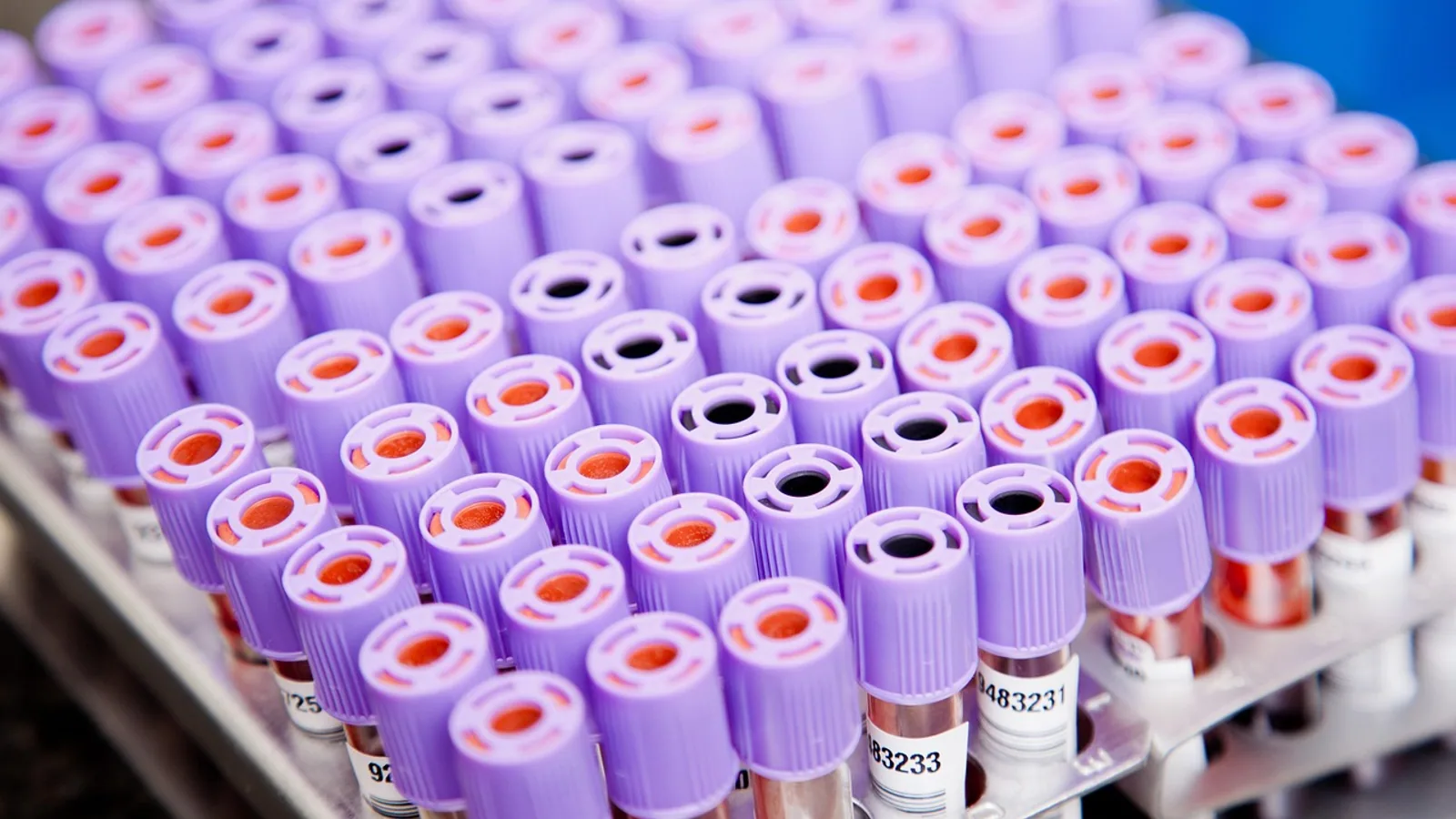 LIMS Explained: Lab Information Management Systems