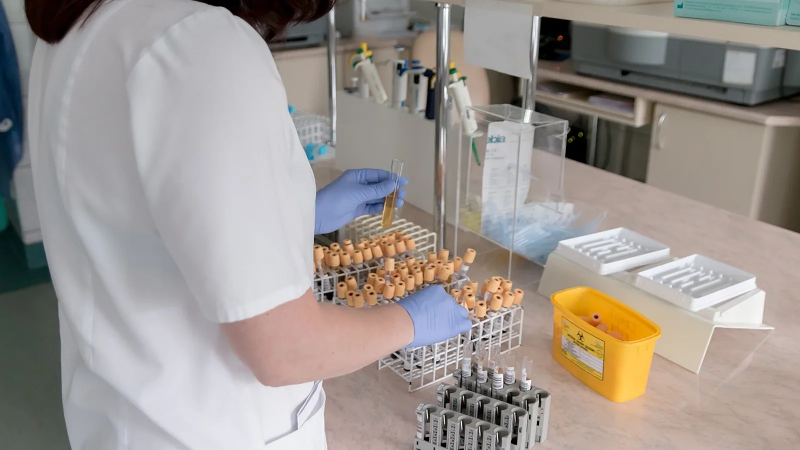 Gas Liquid Chromatography: Uses and Principle