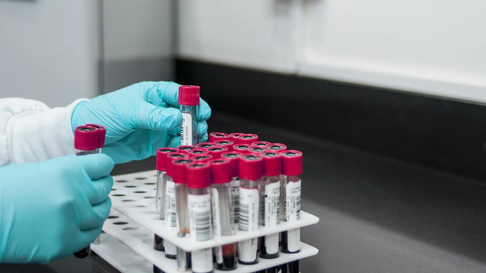 Gain of Function Research: Definition, Methods, and Debate