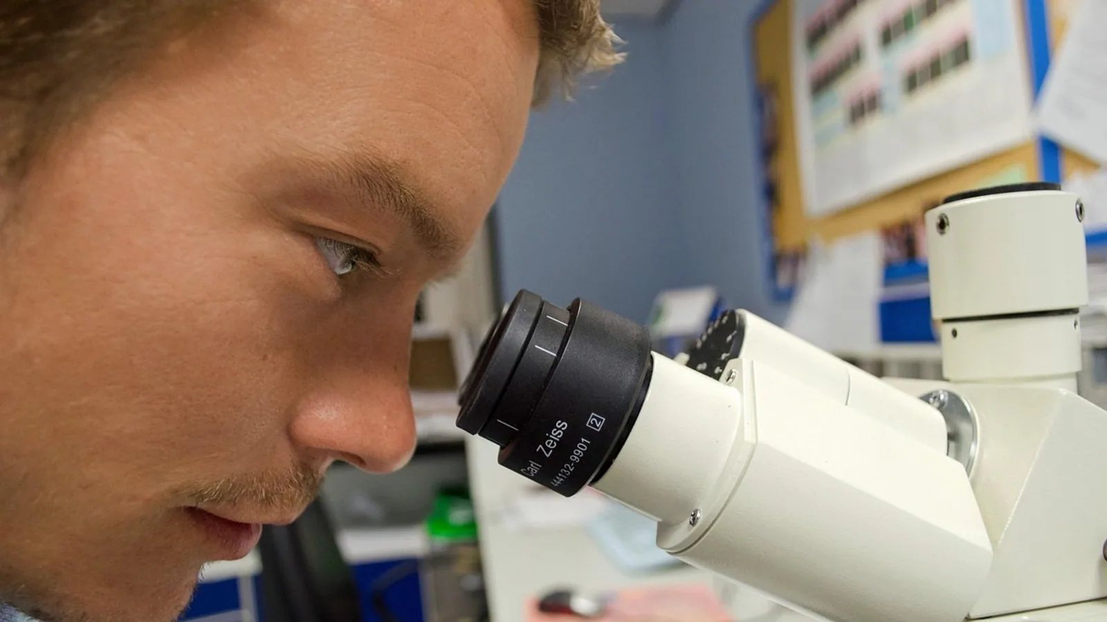 Elastic Cartilage: Histology, Location and Function