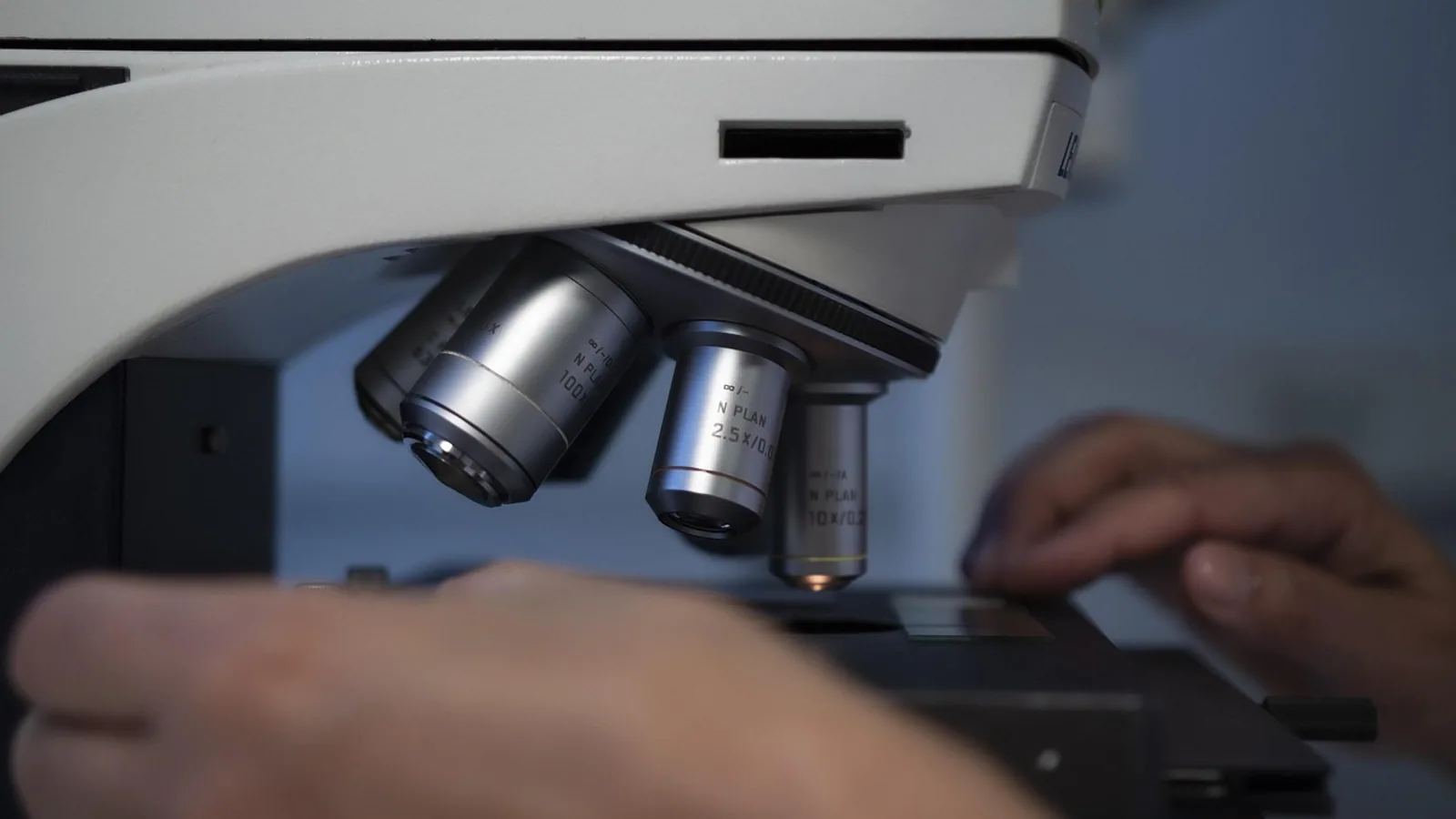 Indirect Fluorescent Antibody Test: How It Works