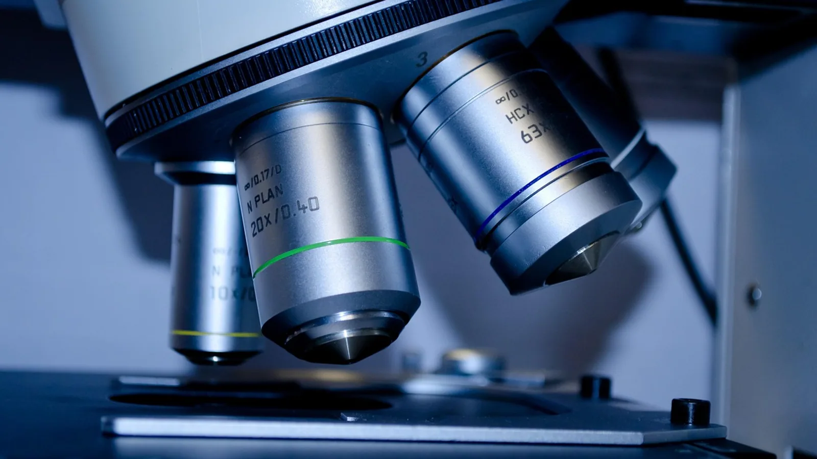 Waxy Casts in Urine: Types and Clinical Meaning