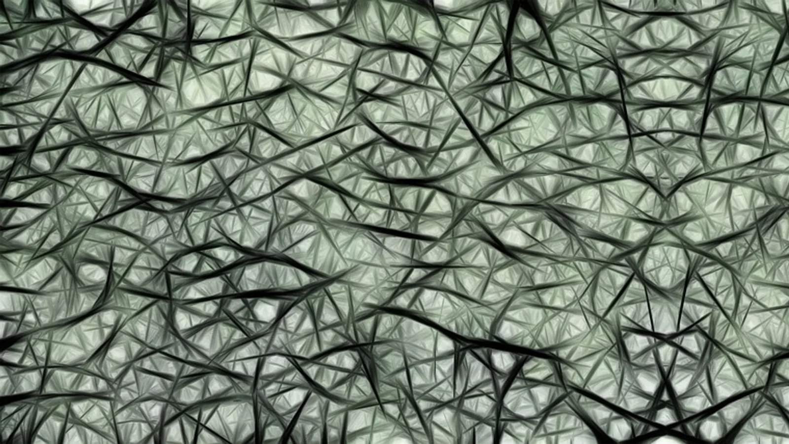 Falx Cerebri: Anatomy, Function, and Dural Reflections