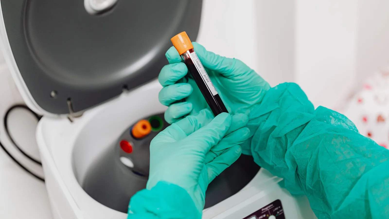 Laboratory scene with a healthcare professional preparing a blood sample for analysis using a centrifuge