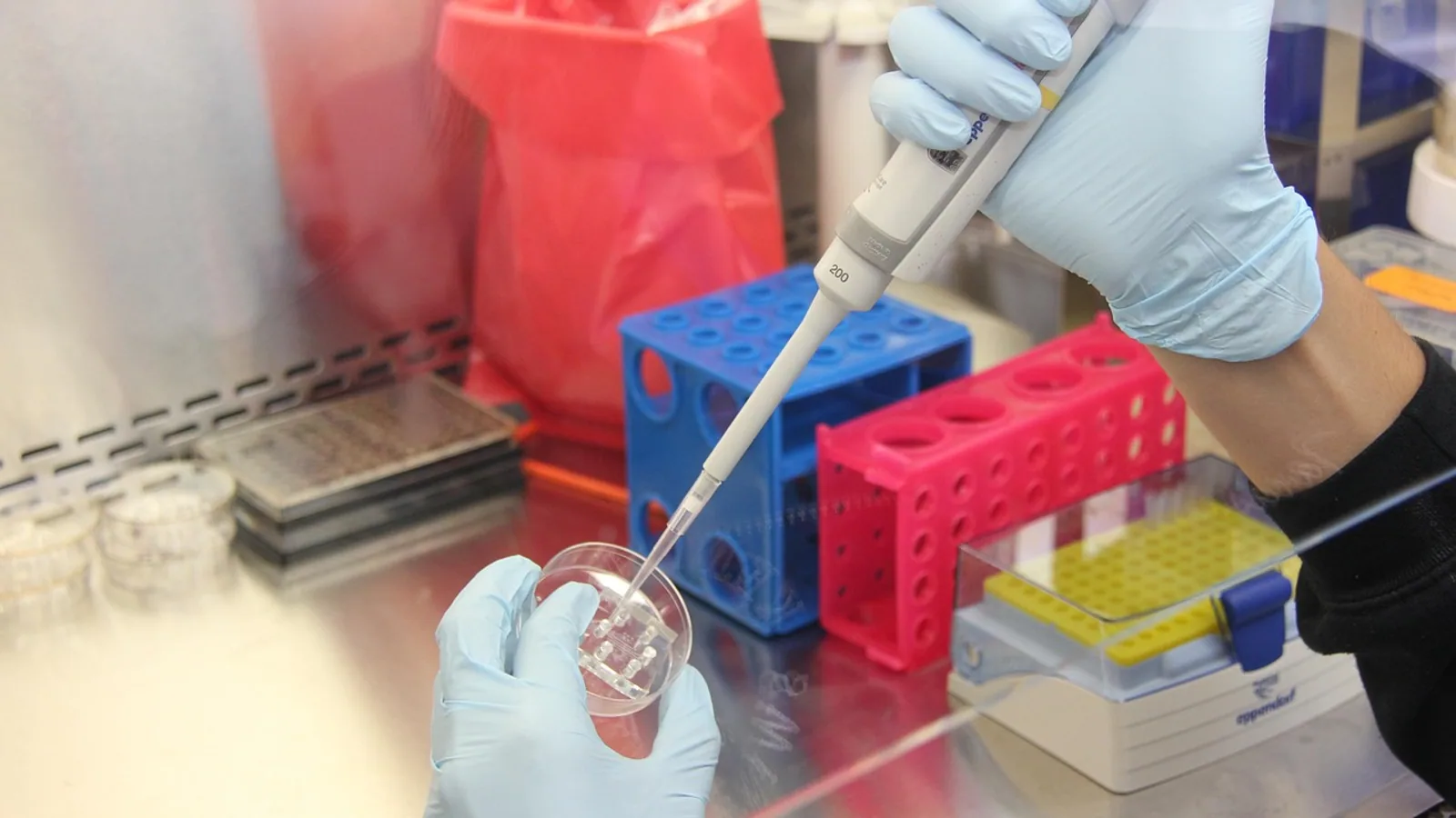 Cyclospora Testing: Methods, Staining, and Interpretation