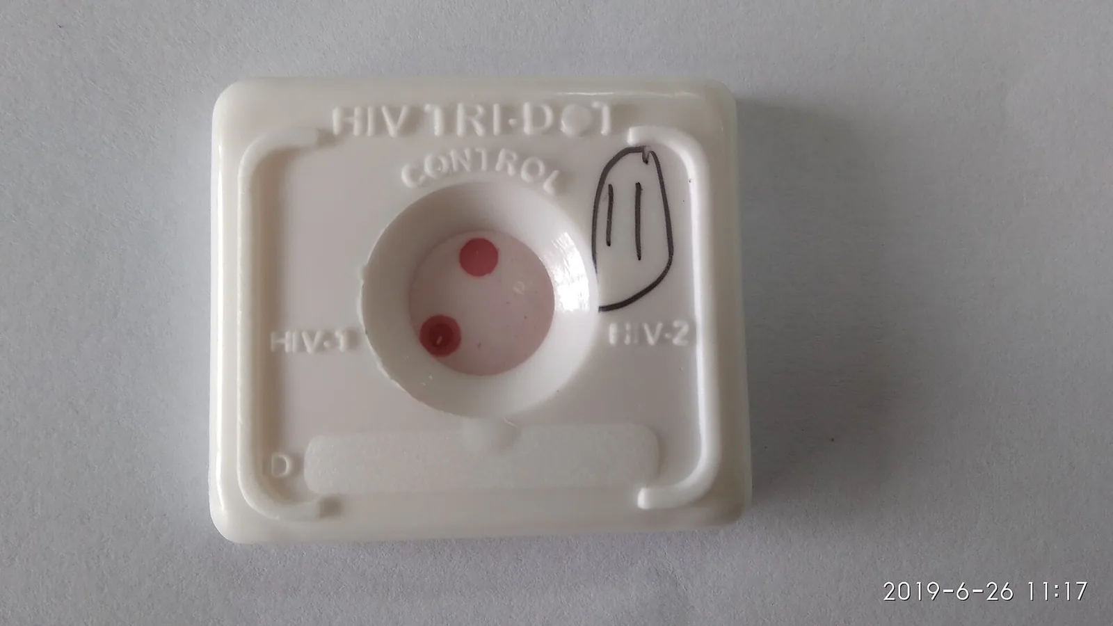 Serology blood test laboratory