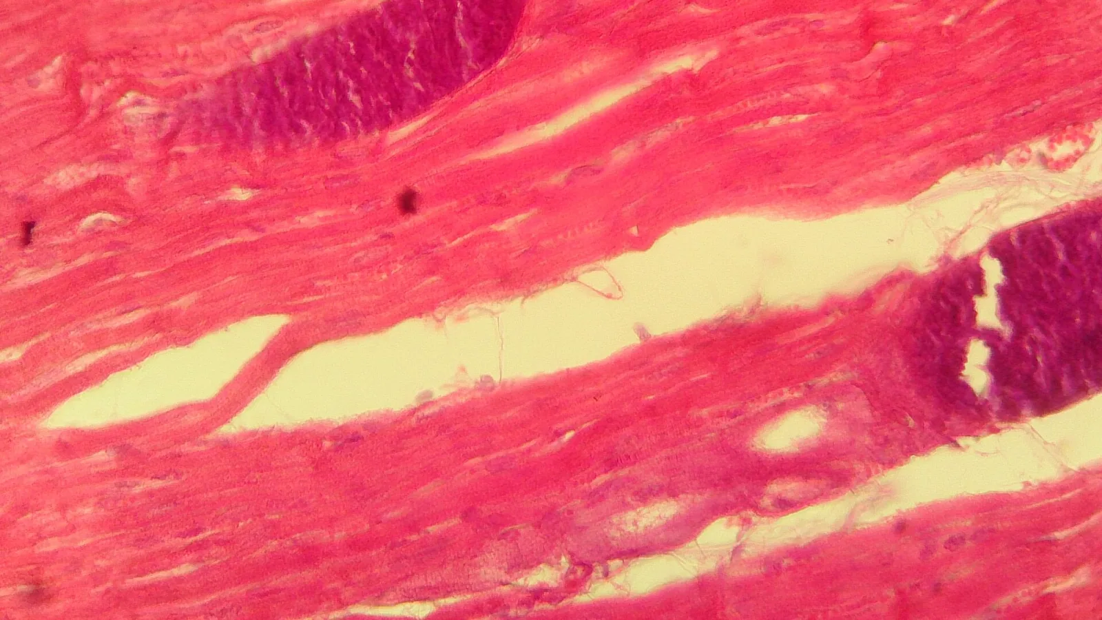H&E micrograph showing Sarcocystis, a protist parasite in cardiac muscle of a 3-year-old sheep (40X)