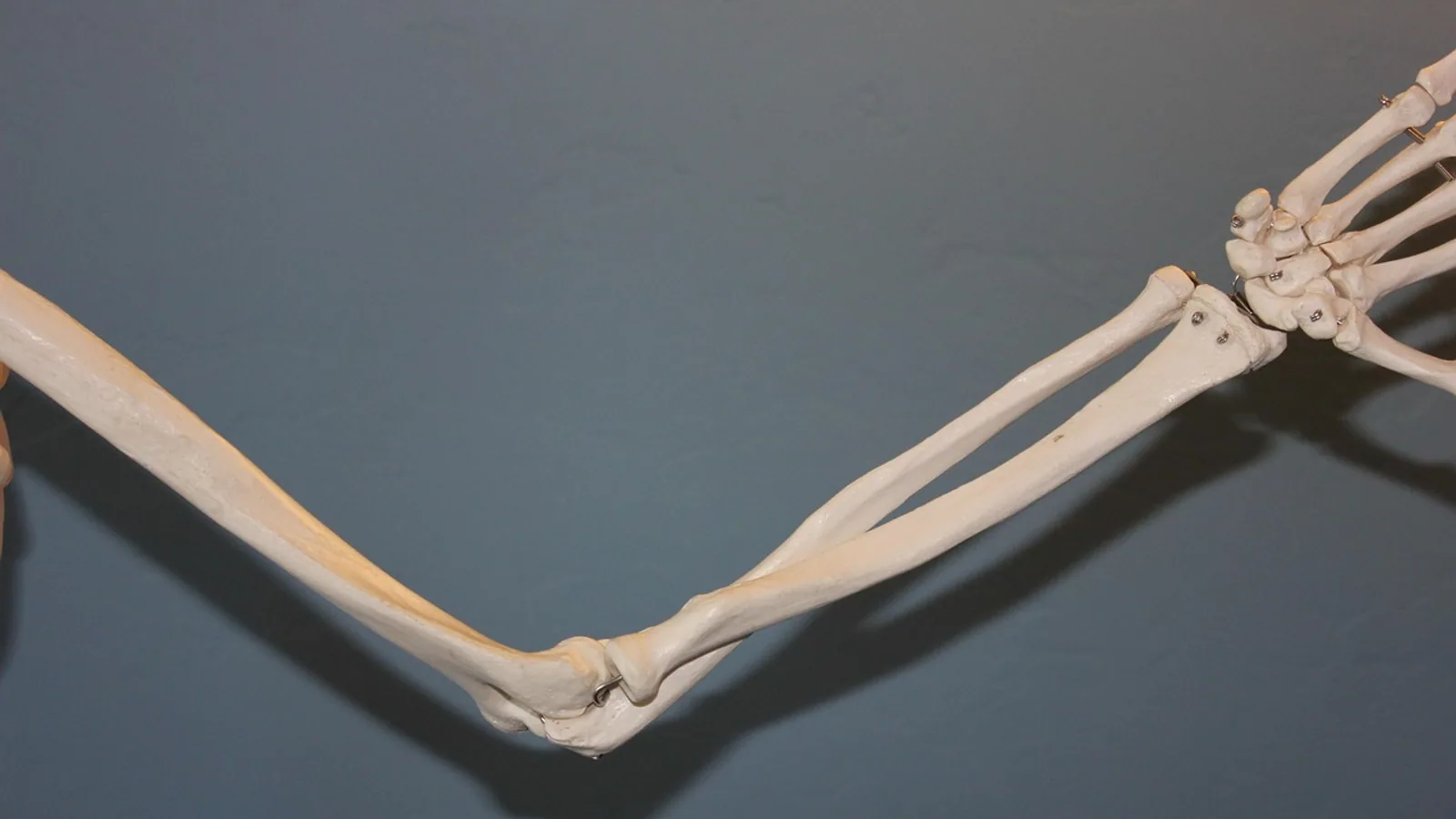 Coronal Cut: Definition and Anatomical Planes
