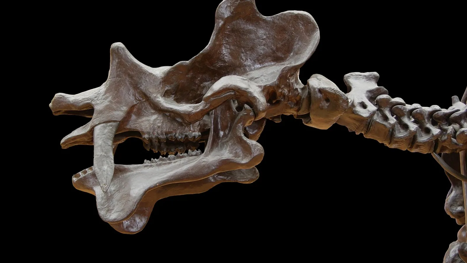 Spinal Column Vertebrae: Regions and Structure