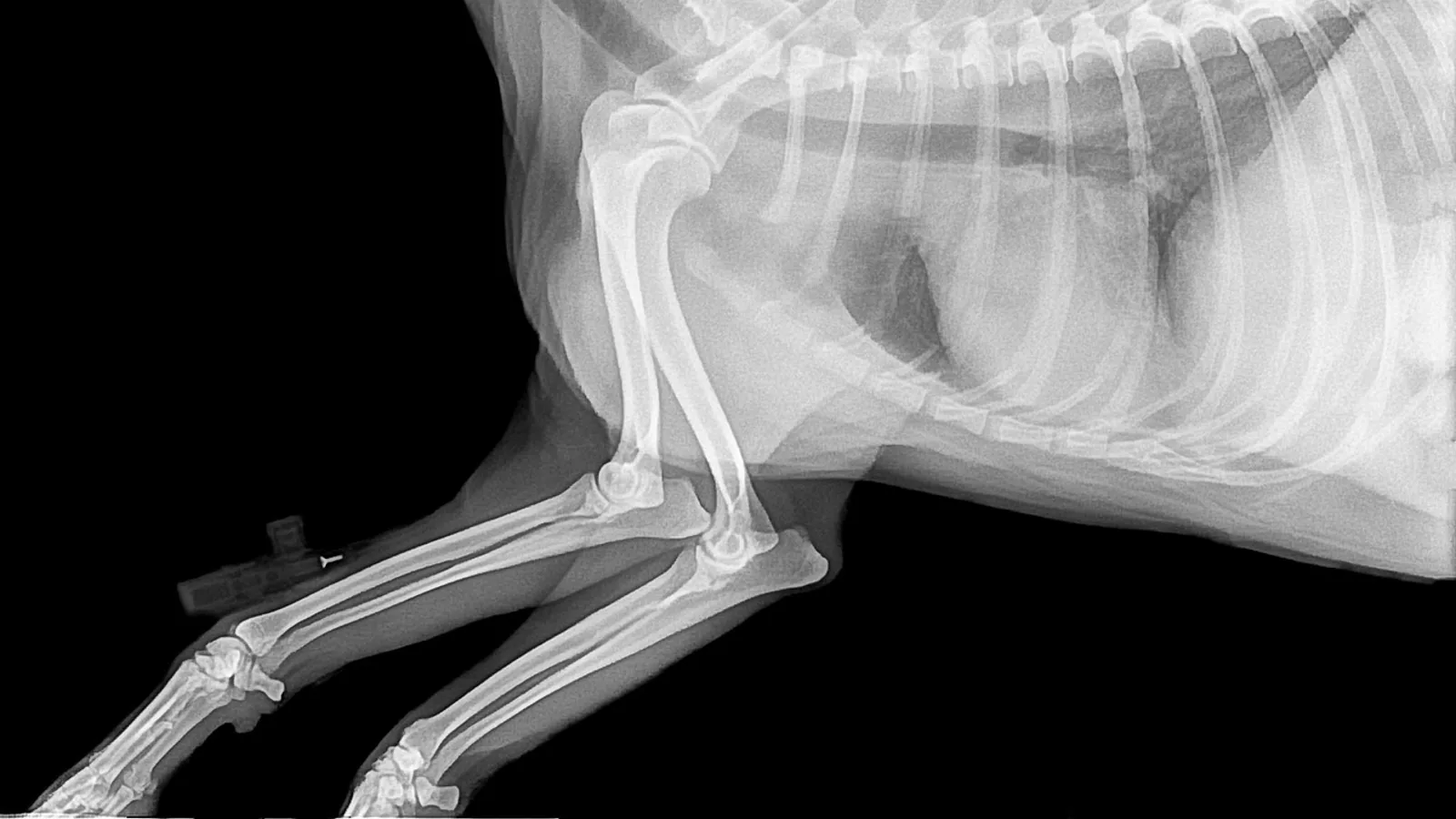 Linea Alba Anatomy: Landmarks and Surgical Use