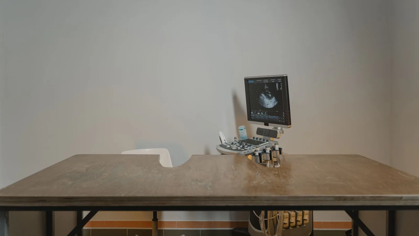 Ultrasound machine setup in a minimalist medical office for patient examinations